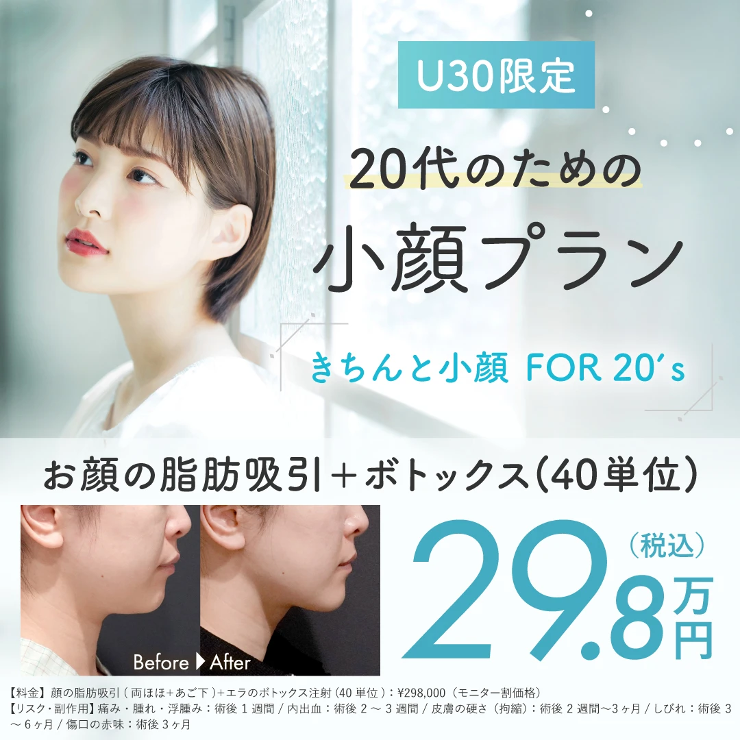 U30限定 20代のための小顔プラン お顔の脂肪吸引＋ボトックス（40単位）