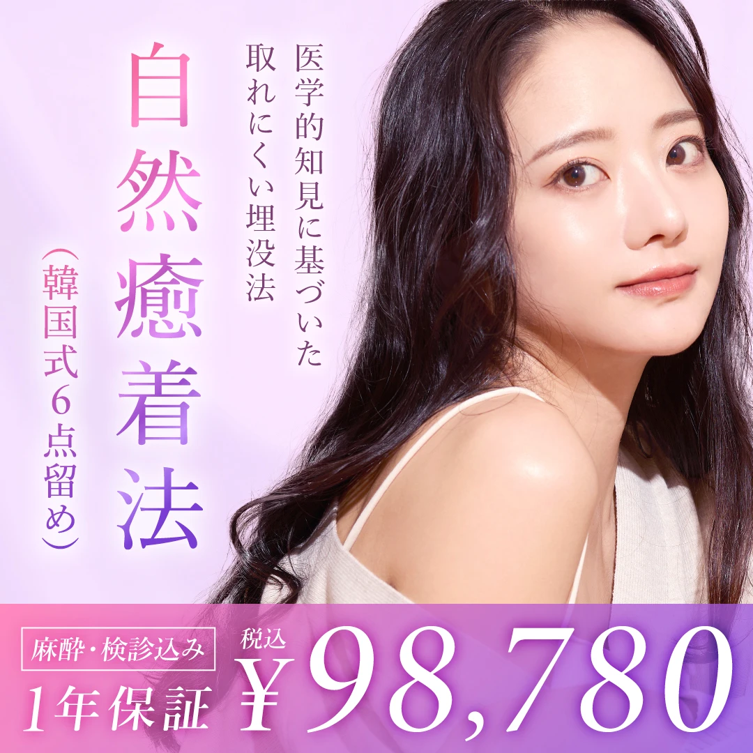 自然癒着法（医学的知見に基づいた取れにくい埋没法　韓国式6点留め）